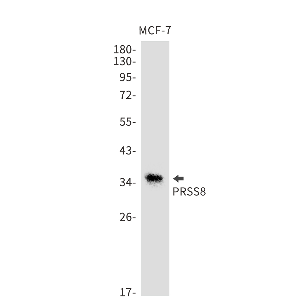 PRSS8 Rabbit mAb ABZ3136