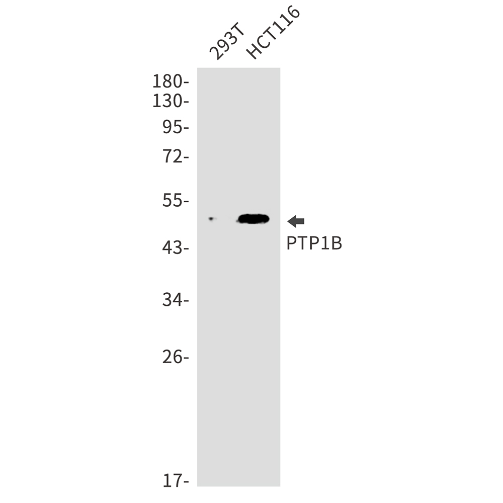 PTP1B Rabbit mAb ABZ3138