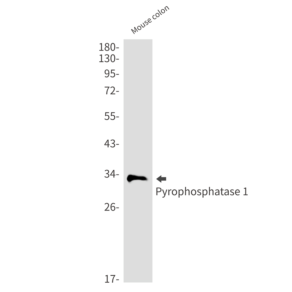 Pyrophosphatase 1 Rabbit mAb ABZ3139