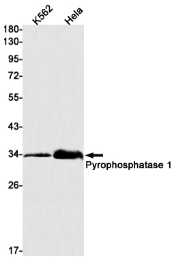 Pyrophosphatase 1 Rabbit mAb ABZ3139