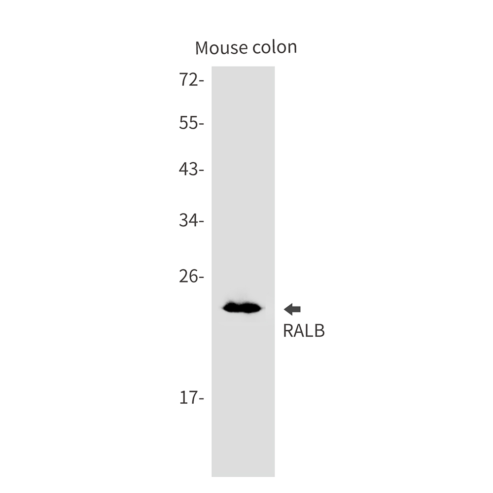 RALB Rabbit mAb ABZ3141