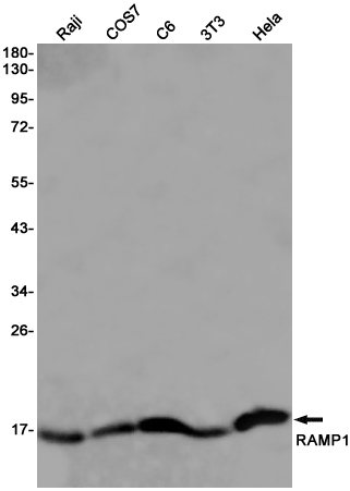 RAMP1 Rabbit mAb ABZ3142