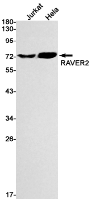 RAVER2 Rabbit mAb ABZ3143