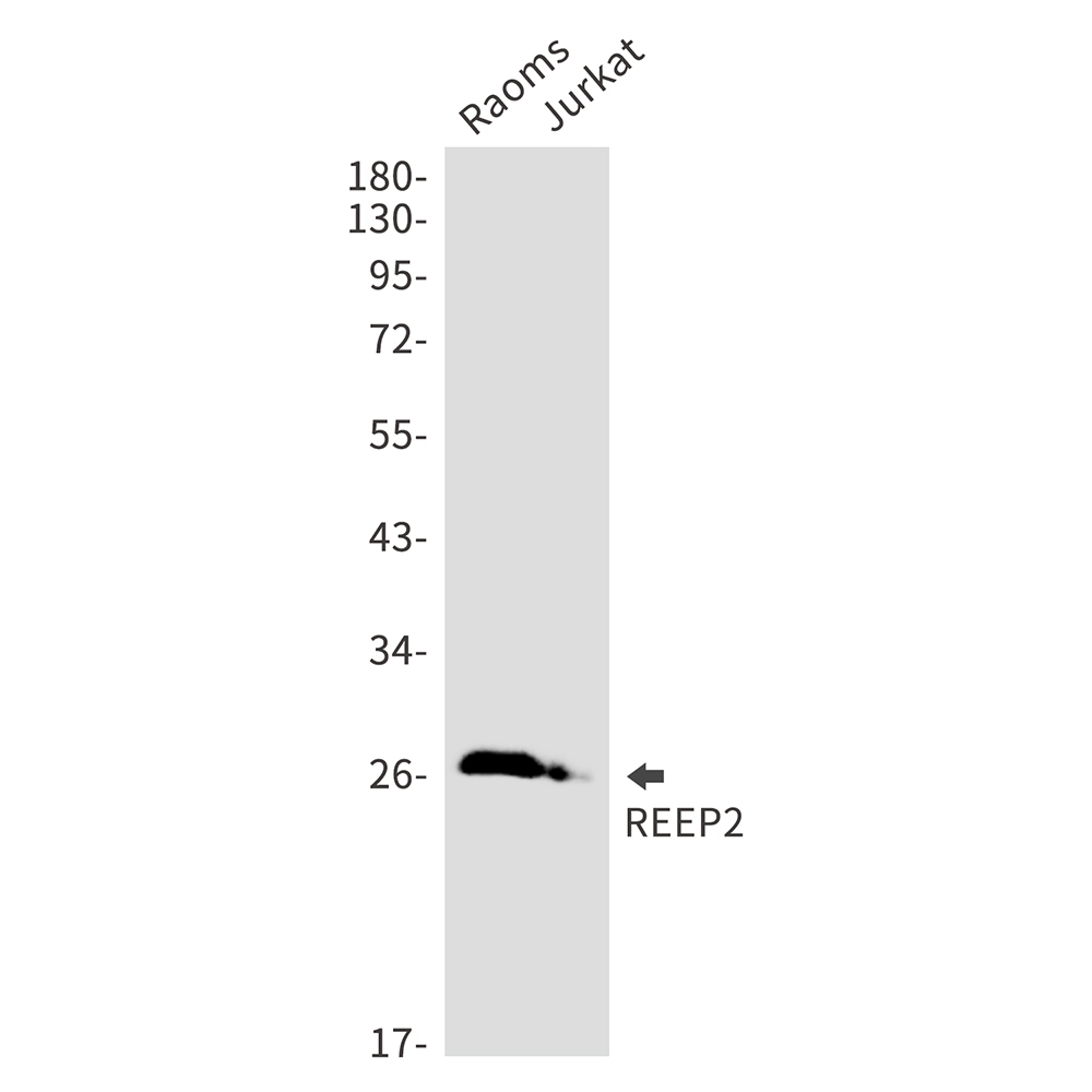 REEP2 Rabbit mAb ABZ3145