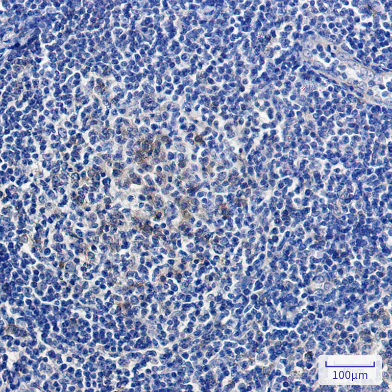 Relaxin 2/RLN2 Rabbit mAb ABZ3146