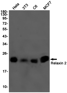 Relaxin 2/RLN2 Rabbit mAb ABZ3146