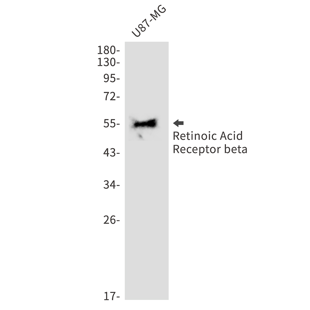 Retinoic Acid Receptor beta Rabbit mAb ABZ3147