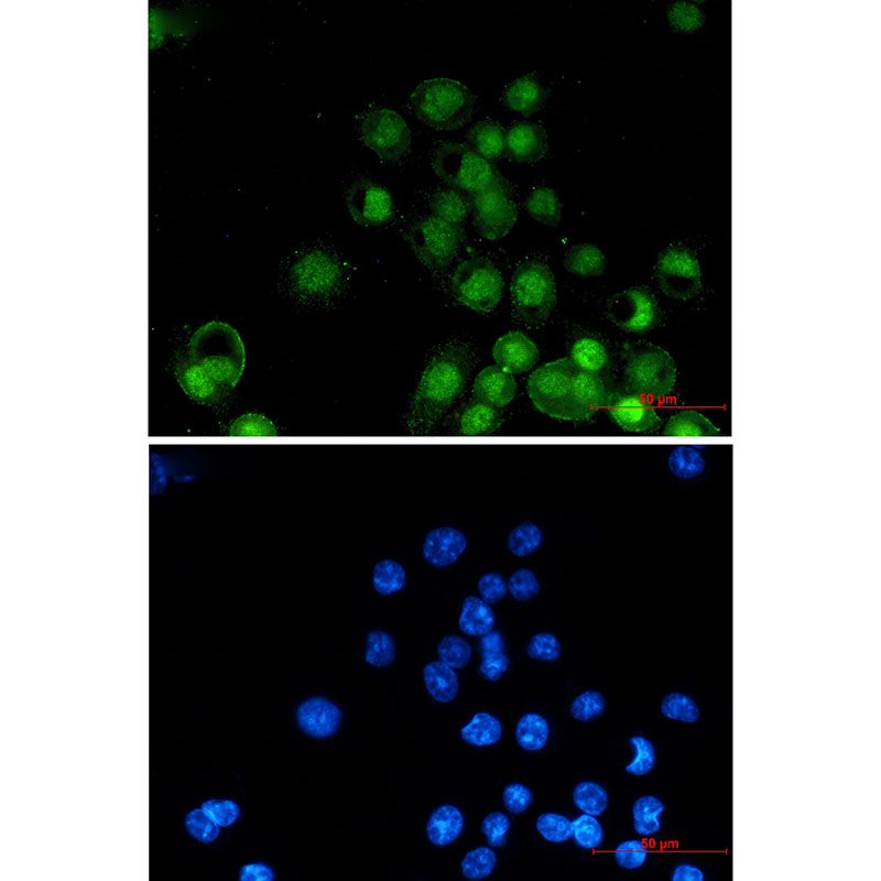 Retinoid X Receptor alpha Rabbit mAb ABZ3148