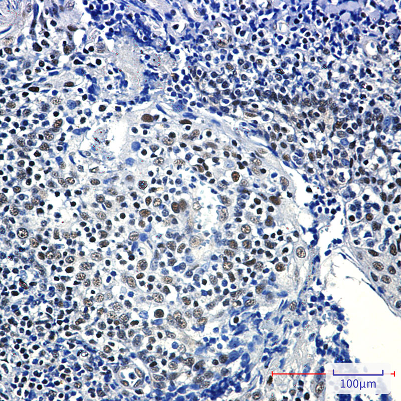 RPA32 Rabbit mAb ABZ3150