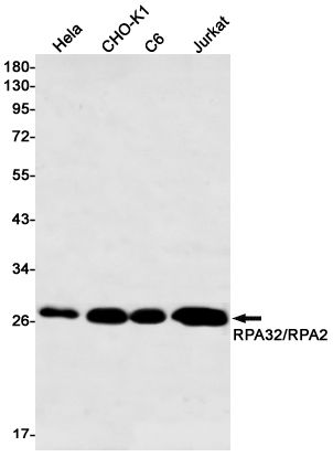 RPA32 Rabbit mAb ABZ3150