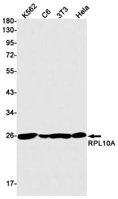 RPL10A Rabbit mAb ABZ3151