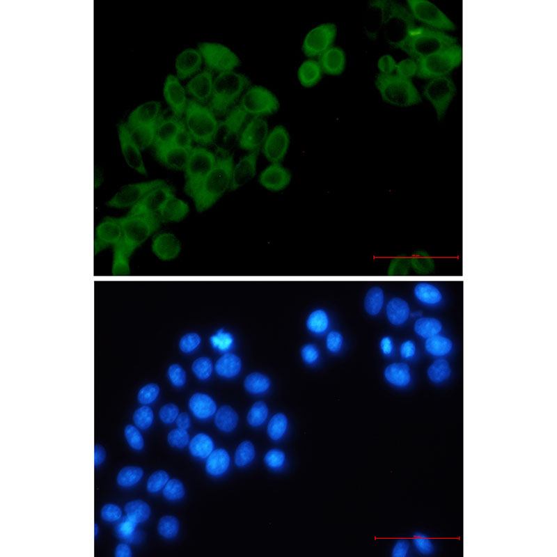RRM1 Rabbit mAb ABZ3153