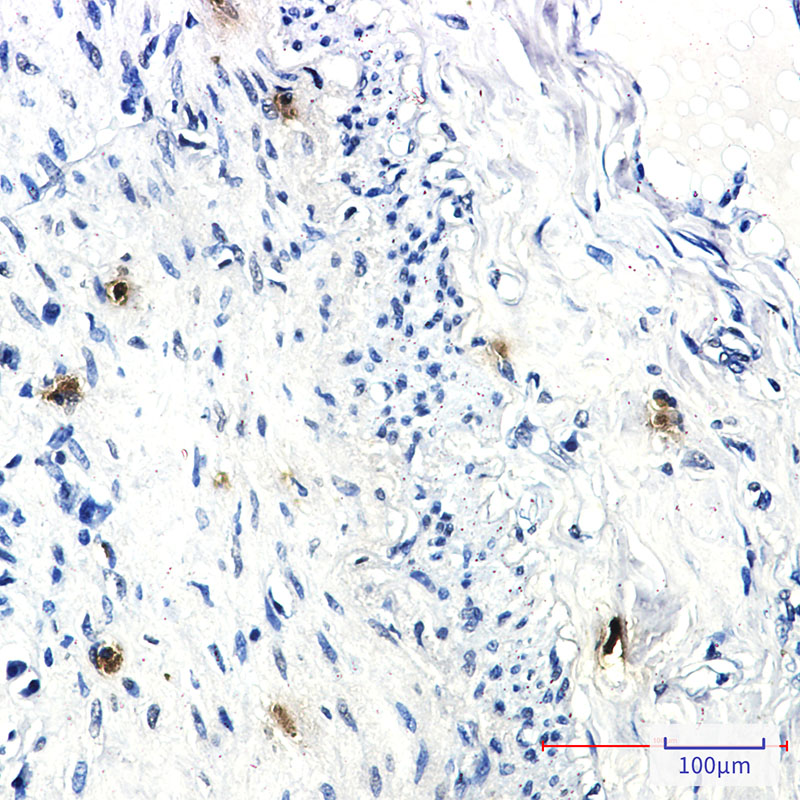 RRM1 Rabbit mAb ABZ3153