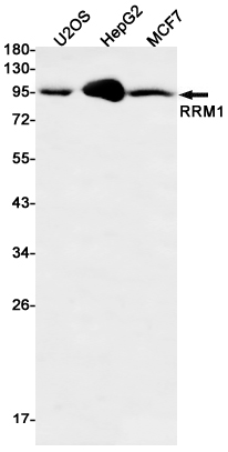 RRM1 Rabbit mAb ABZ3153