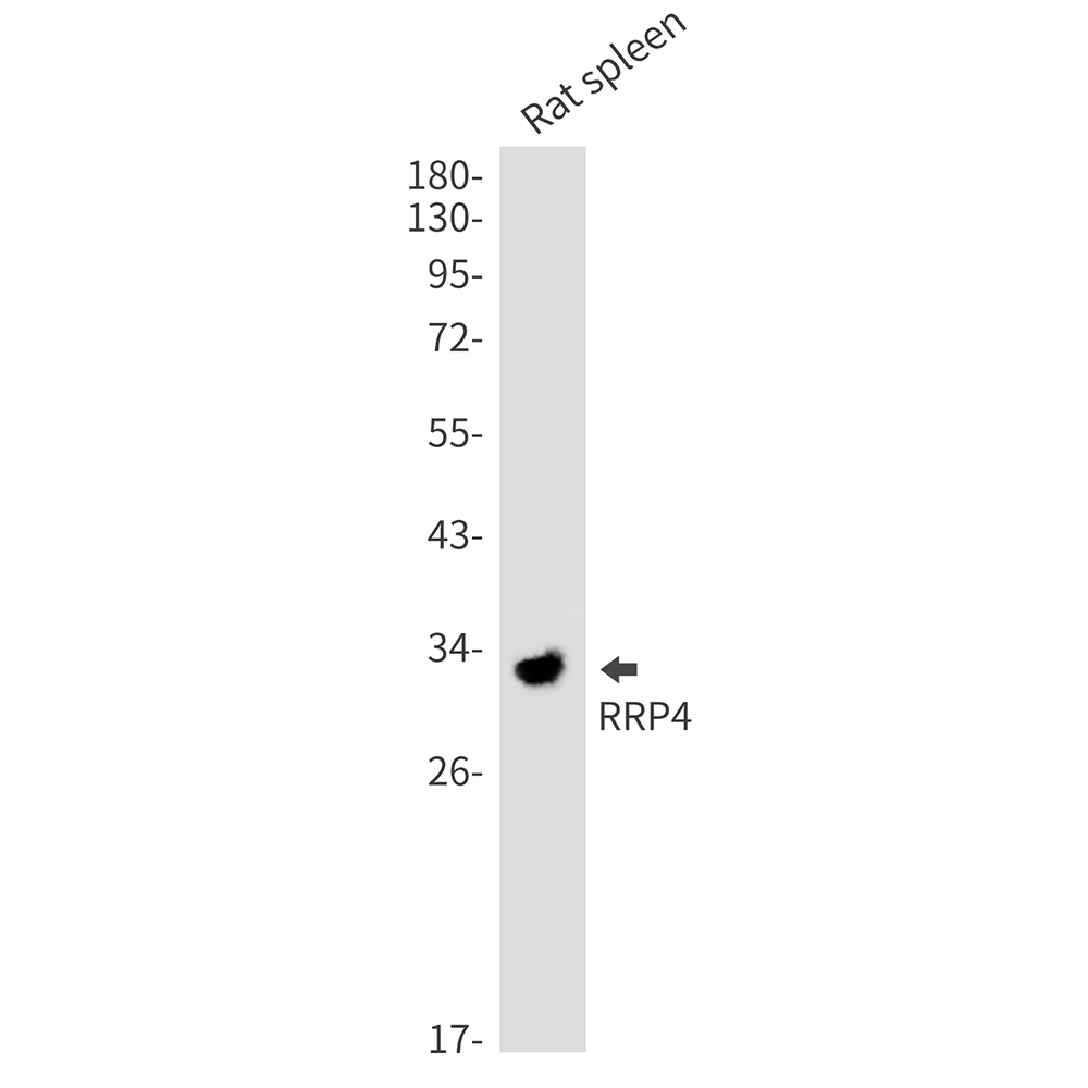 RRP4 Rabbit mAb ABZ3154