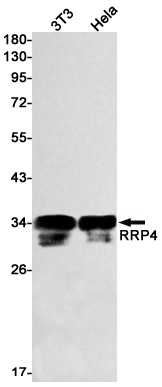 RRP4 Rabbit mAb ABZ3154
