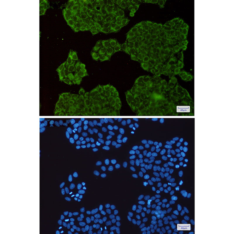 SEC6 Rabbit mAb ABZ3155