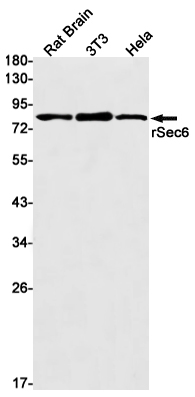 SEC6 Rabbit mAb ABZ3155