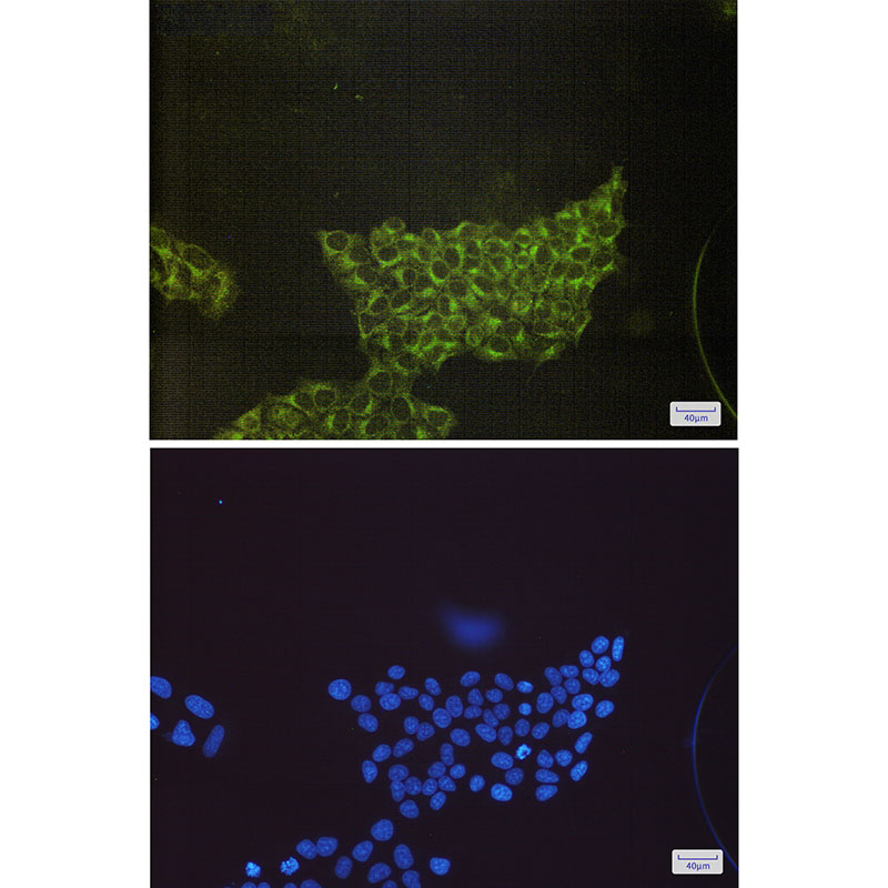 S6K1 Rabbit mAb ABZ3156