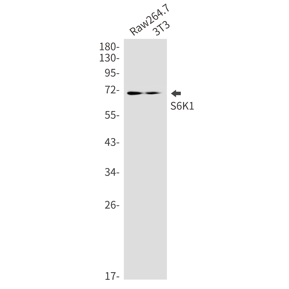 S6K1 Rabbit mAb ABZ3156