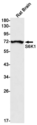 S6K1 Rabbit mAb ABZ3156