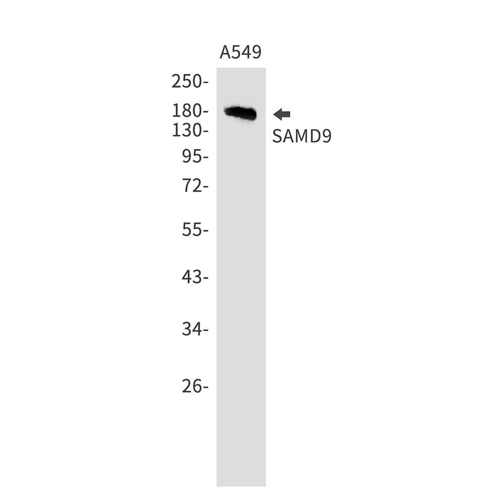 SAMD9 Rabbit mAb ABZ3157