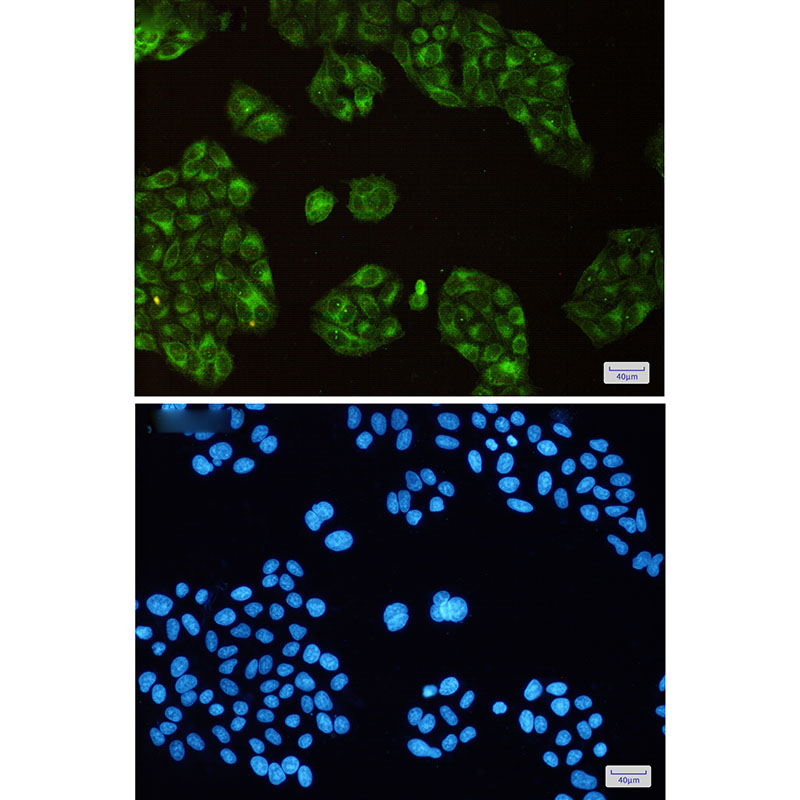 SCD1 Rabbit mAb ABZ3158