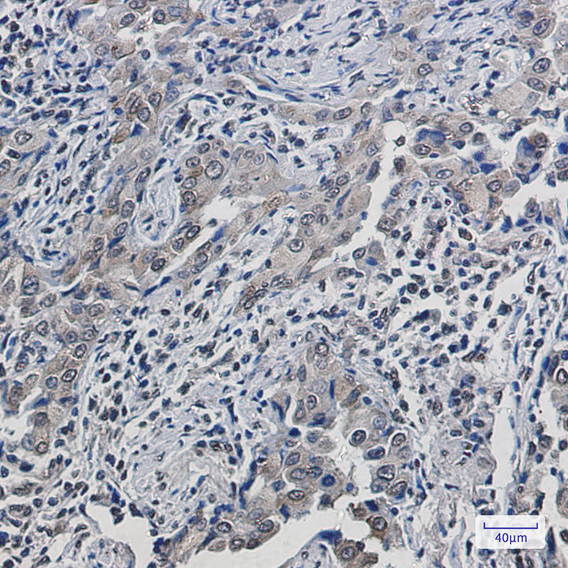 SCD1 Rabbit mAb ABZ3158