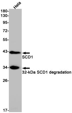 SCD1 Rabbit mAb ABZ3158