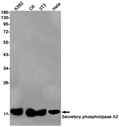 PLA2G2A Rabbit mAb ABZ3159