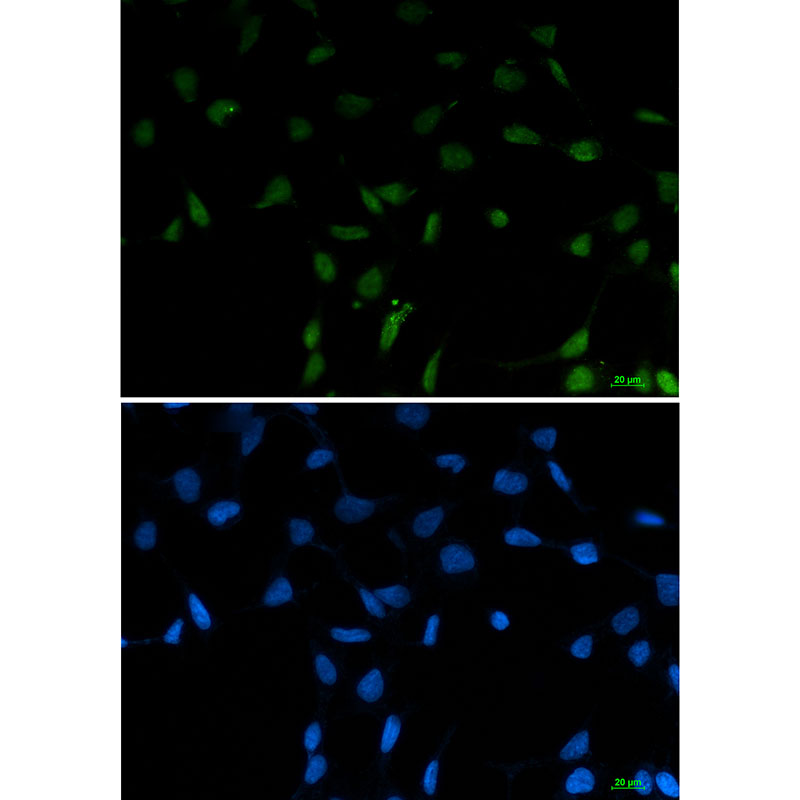 SFPQ Rabbit mAb ABZ3161
