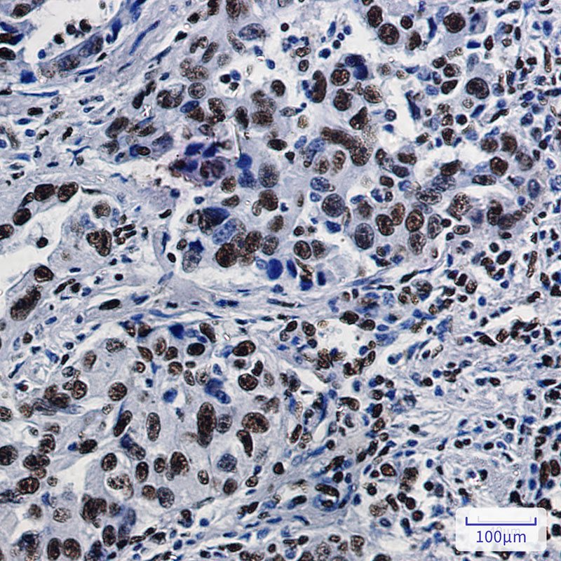 SFPQ Rabbit mAb ABZ3161