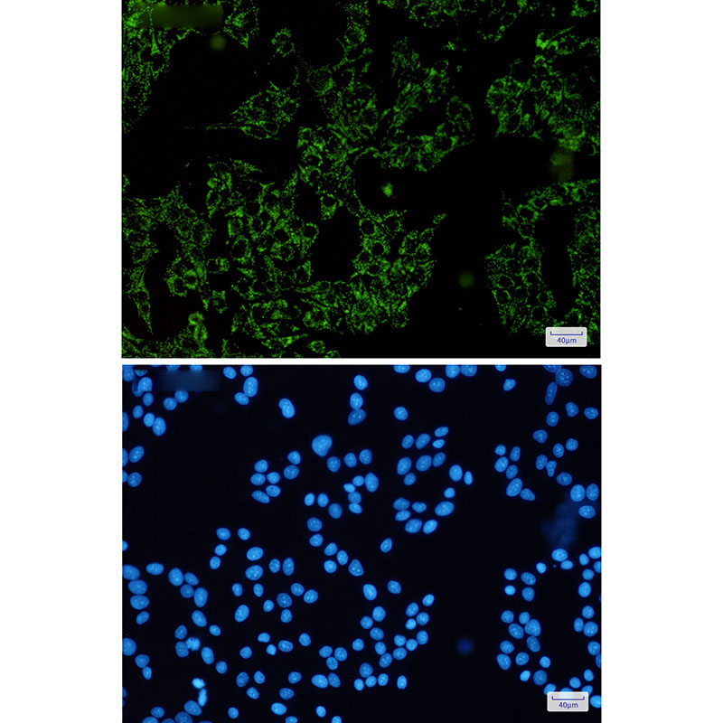 SGSM1 Rabbit mAb ABZ3162