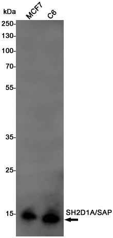 SH2D1A/SAP Rabbit mAb ABZ3163