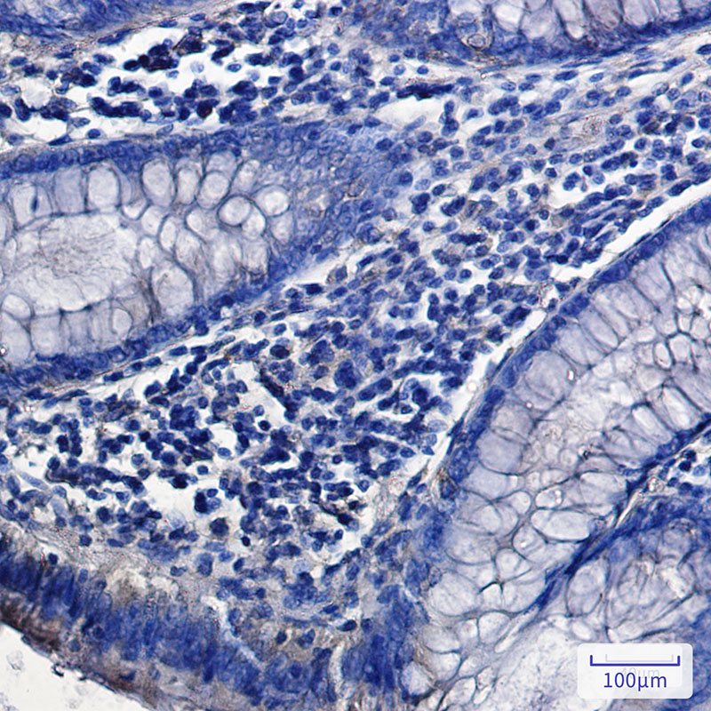 SH3PX1/SNX9 Rabbit mAb ABZ3164