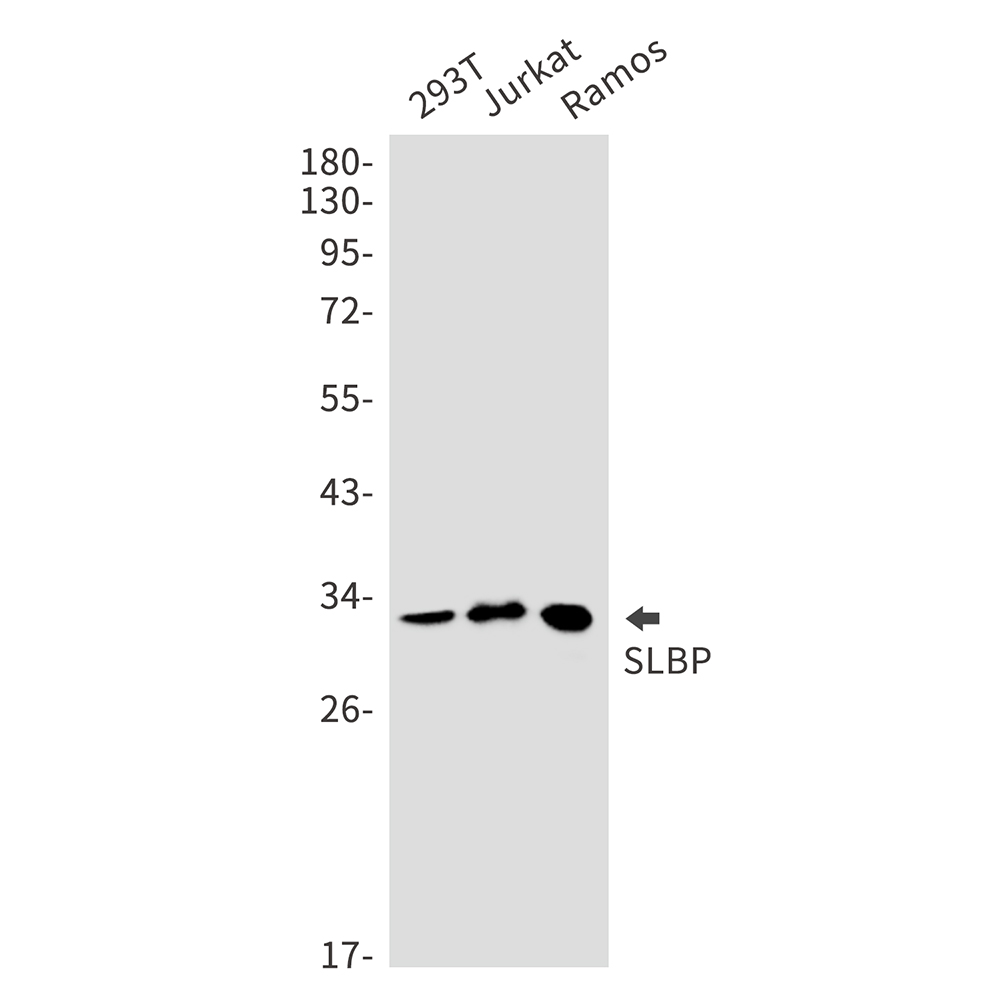 SLBP Rabbit mAb ABZ3166