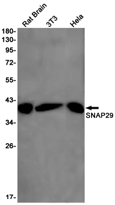 SNAP29 Rabbit mAb ABZ3168