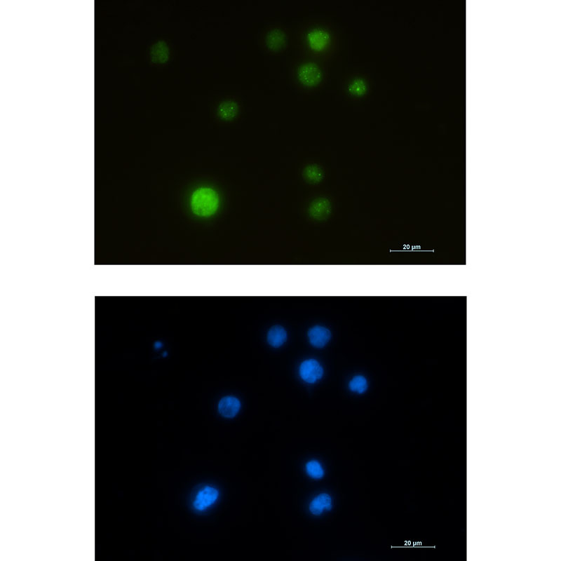 SMARCA5 Rabbit mAb ABZ3169
