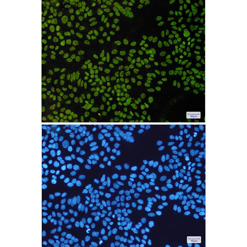 SNF5/SMARCB1 Rabbit mAb ABZ3170