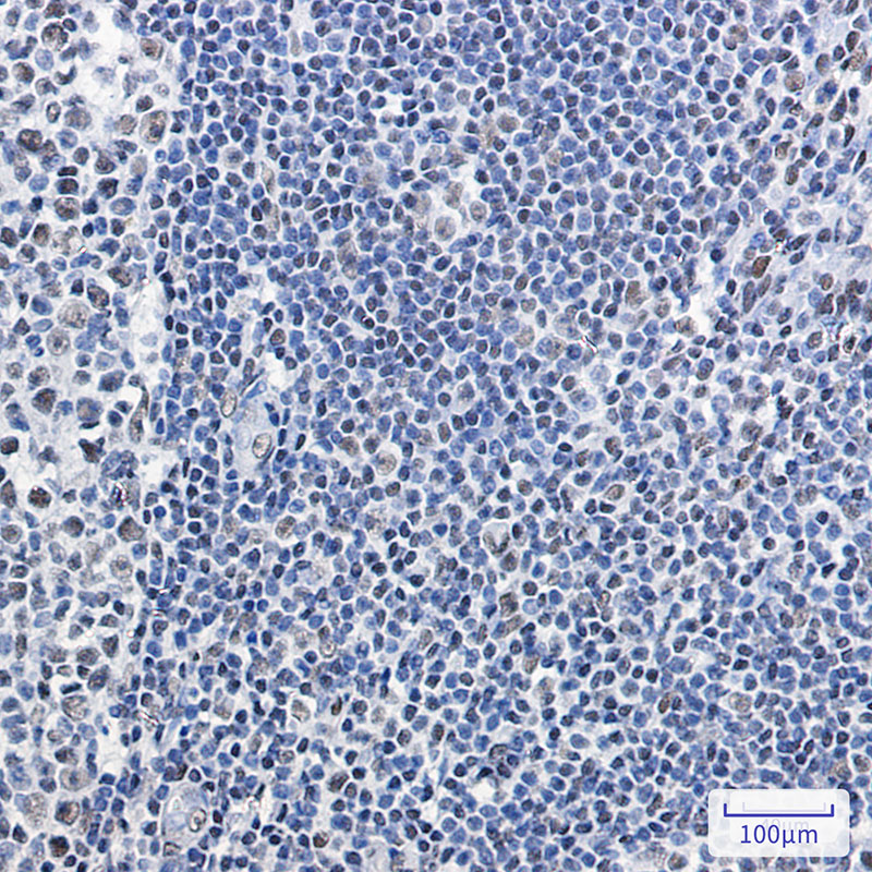 SNF5/SMARCB1 Rabbit mAb ABZ3170