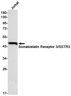 Somatostatin Receptor 3 Rabbit mAb ABZ3173
