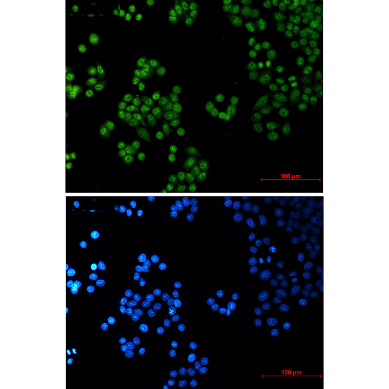 SP1 Rabbit mAb ABZ3174