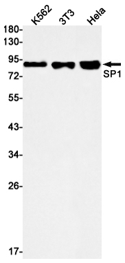 SP1 Rabbit mAb ABZ3174