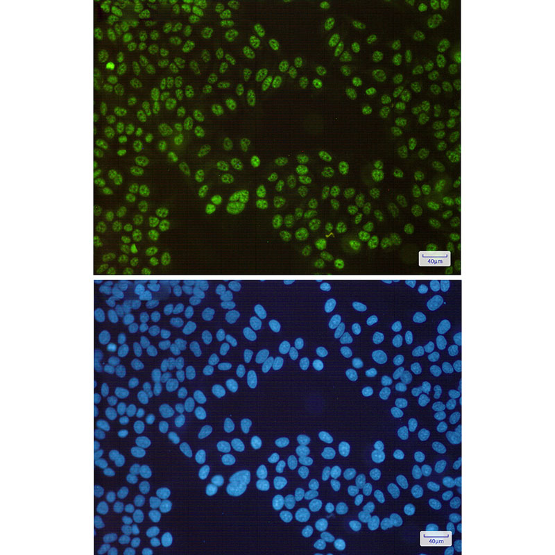 SP1 Rabbit mAb ABZ3175