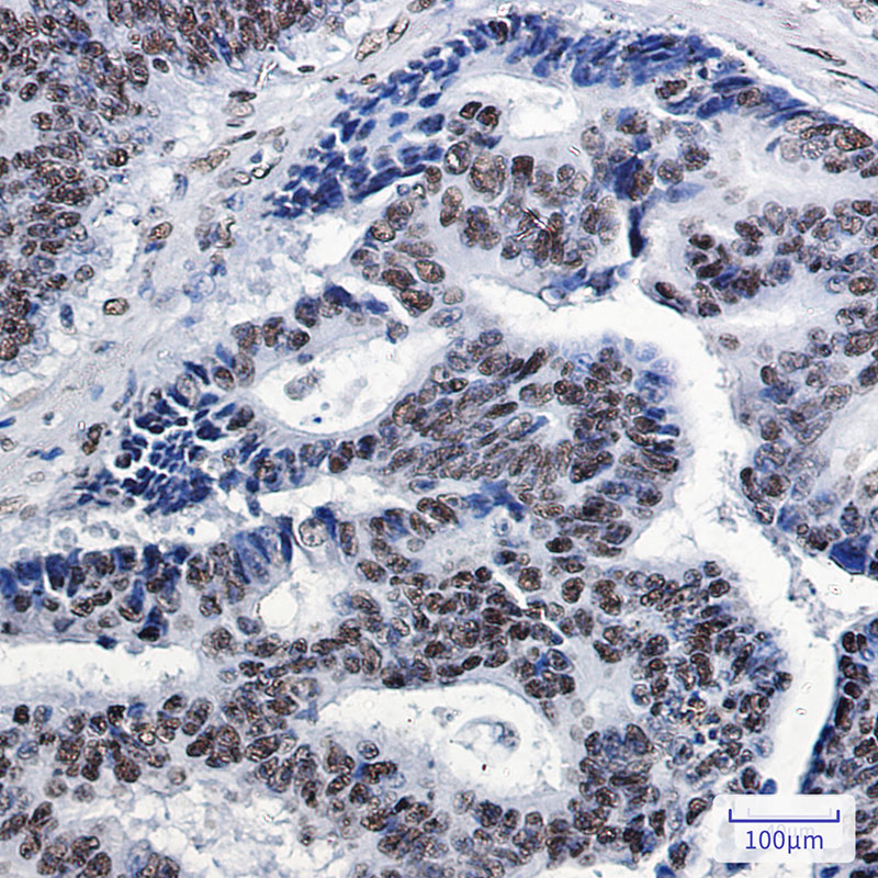 SP1 Rabbit mAb ABZ3175