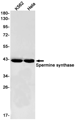 Spermine Synthase Rabbit mAb ABZ3176