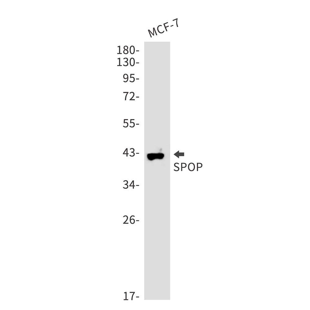 SPOP Rabbit mAb ABZ3177