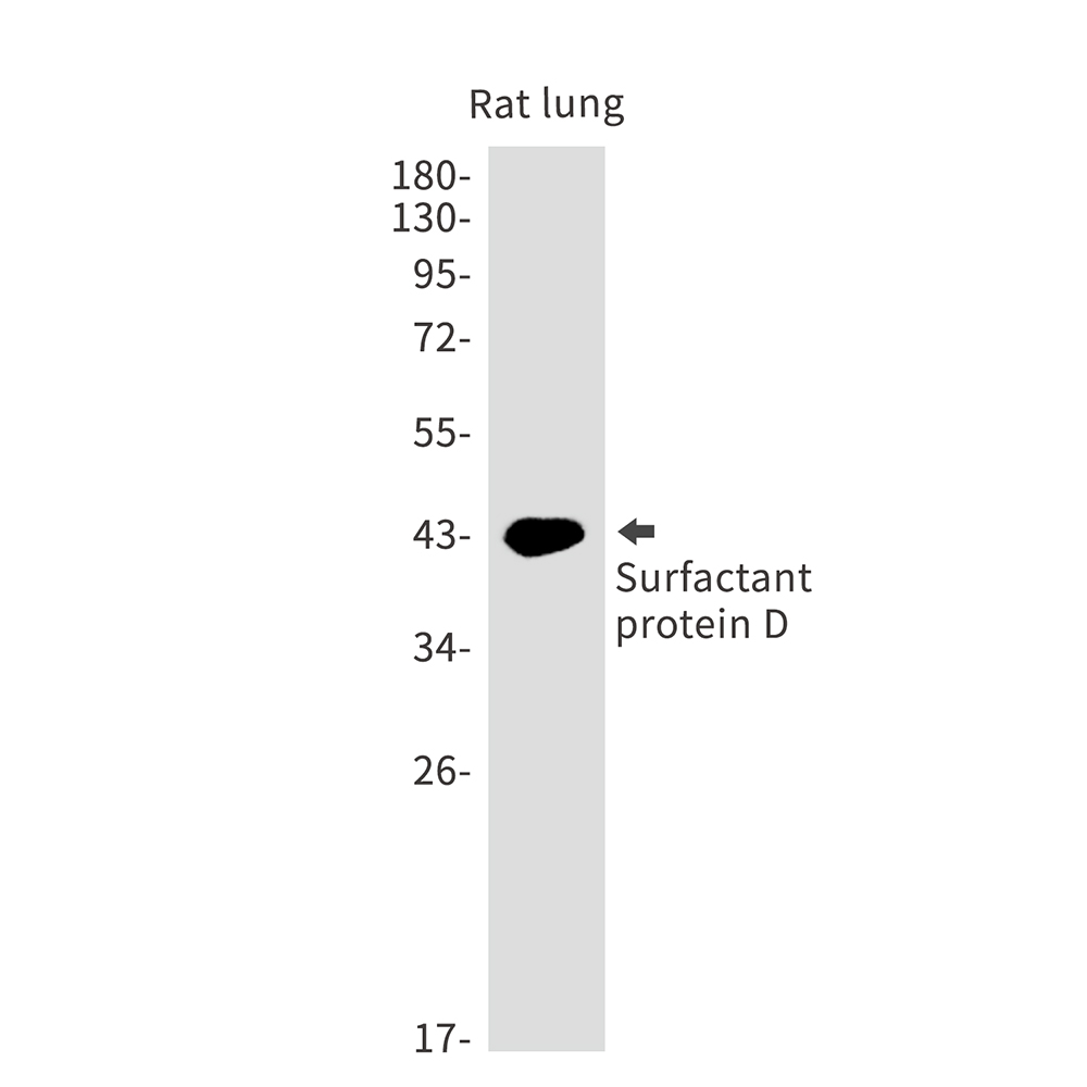 Pulmonary Surfactant Associated Protein D Rabbit mAb ABZ3179