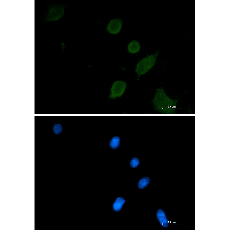 Synaptophysin Rabbit mAb ABZ3181