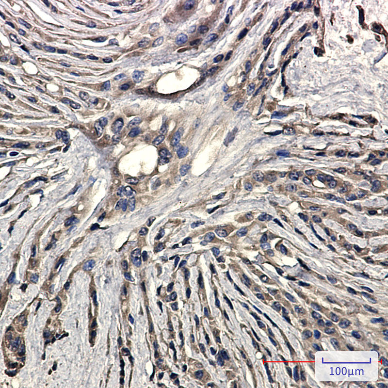 Synaptophysin Rabbit mAb ABZ3181